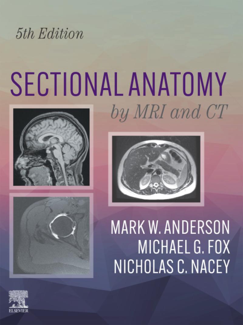 Sectional Anatomy by MRI and CT by Mark W Anderson Michael G Fox Biology Diagrams